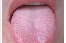 你的舌头出卖了你的健康，赶紧来看一下你的舌苔-古方玉灵膏-贡轩园天然守真。